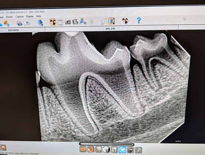 Digital Dental Radiology